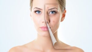 How Important Is Product Quality in the Derma PCD Business